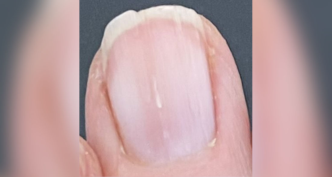 Here’s What Your Nails Say About Your Health